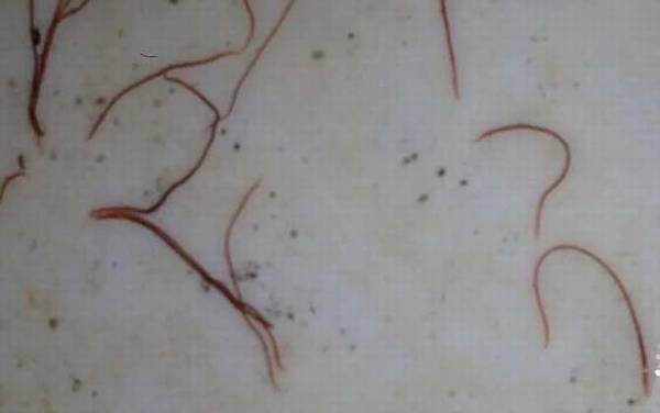 红虫和红线虫有什么区别?