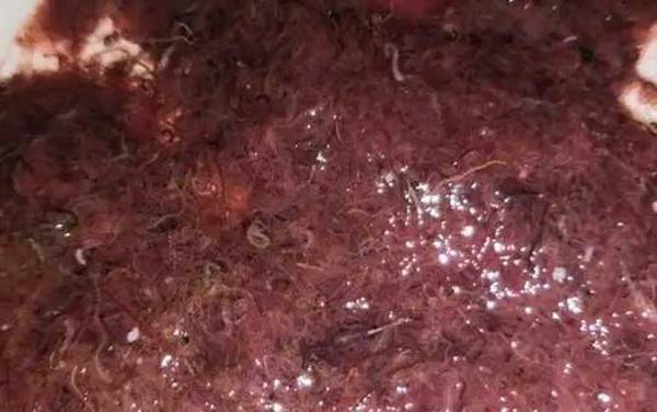 红虫和红线虫有什么区别?