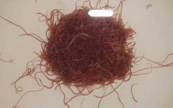 红线虫会钻进人体吗?